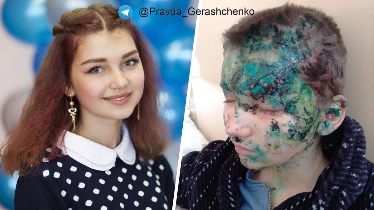 olex_scherba's tweet image. Her name is Maryna (15). 
#Russia bombarded her home in #Kharkiv oblast. 

#StandWithUkraine #RussianWarCrimes #ArmUkraineNow