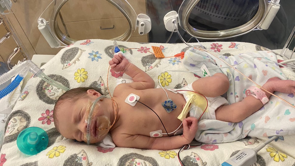 RealJasonNelson's tweet image. Tempest isn’t doing well.
We have moved over to NICU, and I will keep you updated as we get more information.
We have faith. She is loved.