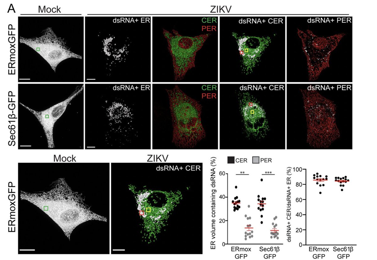 Hamarneh_MIA's tweet photo. Our paper #Super_resolution #microscopy &amp; #deeplearning identify #zika virus reorganization of the #endoplasmic_reticulum selected for Editor’s Choice by Nature Scientific Reports
https://t.co/7XClwbCXIp
https://t.co/Snlibv5VrZ
@SFU_CompSci @NabiRobert @RoryKMLong @BenCardoen https://t.co/H7fINbzeES