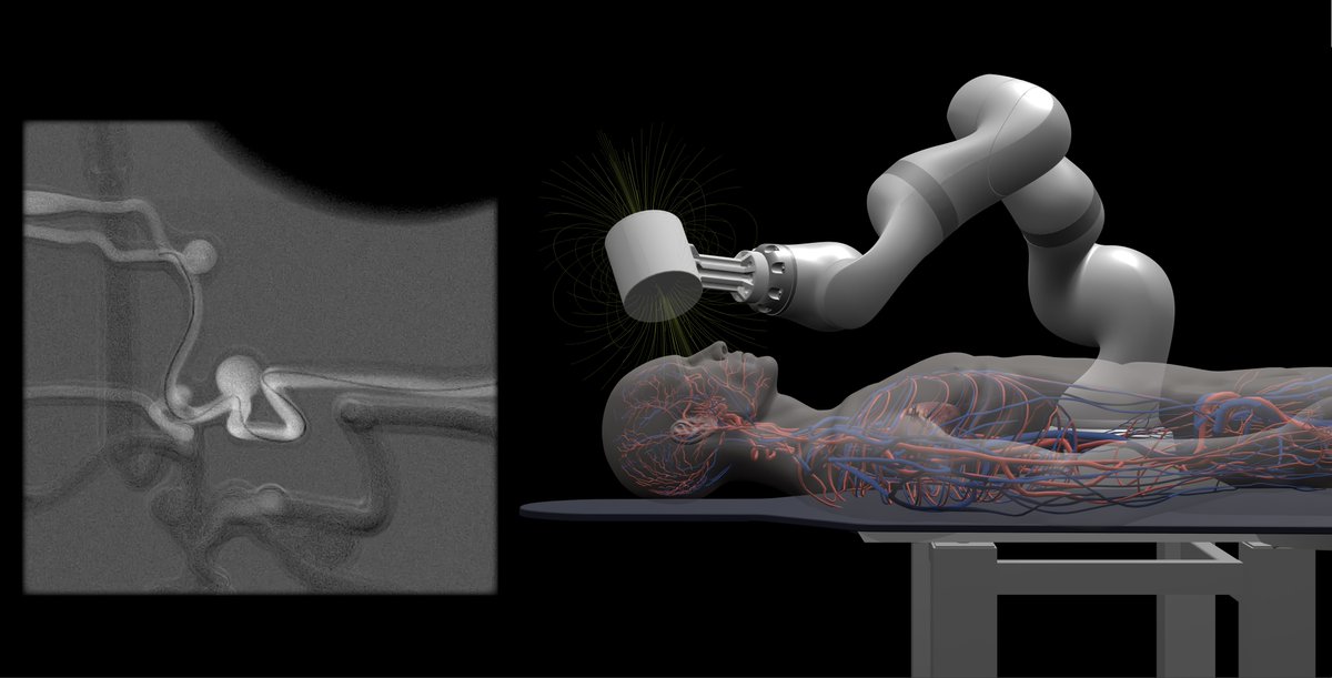 New in <a href="/SciRobotics/">Science Robotics</a>: A #Robot device could enhance #Neurosurgery teleoperations for #Strokes and #BrainAneurysms—situations where timing is crucial and specialists may not be nearby. 

📝: fcld.ly/q5npx1p