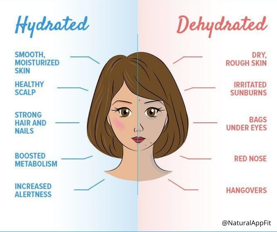 dyr Gå op og ned Bonde Maria Daniels on Twitter: "Hydrated VS Dehydrated! #healthylifestyle #water  https://t.co/CSYuj5pvjw" / Twitter