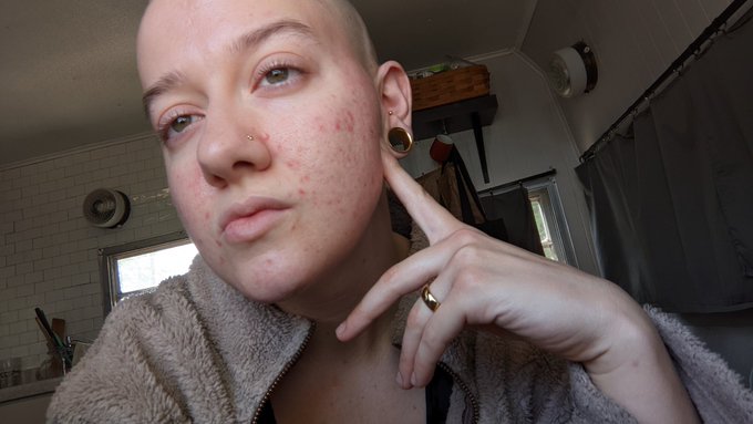 Gold titanium is my one true love.  #nonbinary #trans #piercings https://t.co/hdxVJIiwzD<a href="/tag/nonbinary"class="tags">#nonbinary</a><a href="/tag/piercings"class="tags"><span>#piercings</span></a><a href="/tag/trans"class="tags"><span>#trans</span></a>