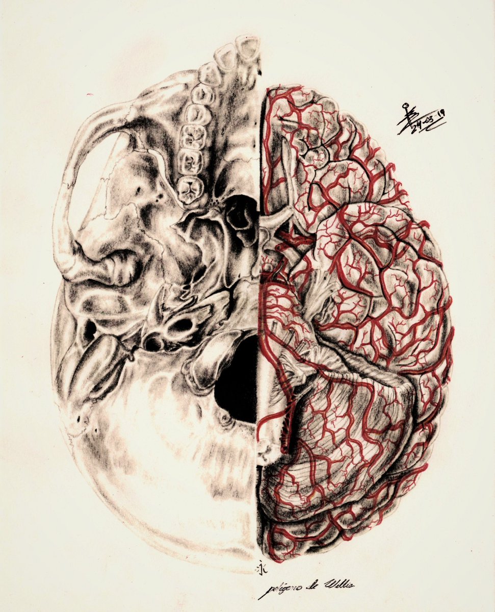 DrCarlosAndresG's tweet photo. Hablemos del «Polígono de Willis». Que no es ni polígono, ni tampoco de Willis. 
Una idea errónea que está muy arraigada en el personal de la salud es asumir la perfección anatómica del CÍRCULO ARTERIAL CEREBRAL. 

abro neurohilo🧠✍️ @Cuneatos https://t.co/0U5B1YS91n