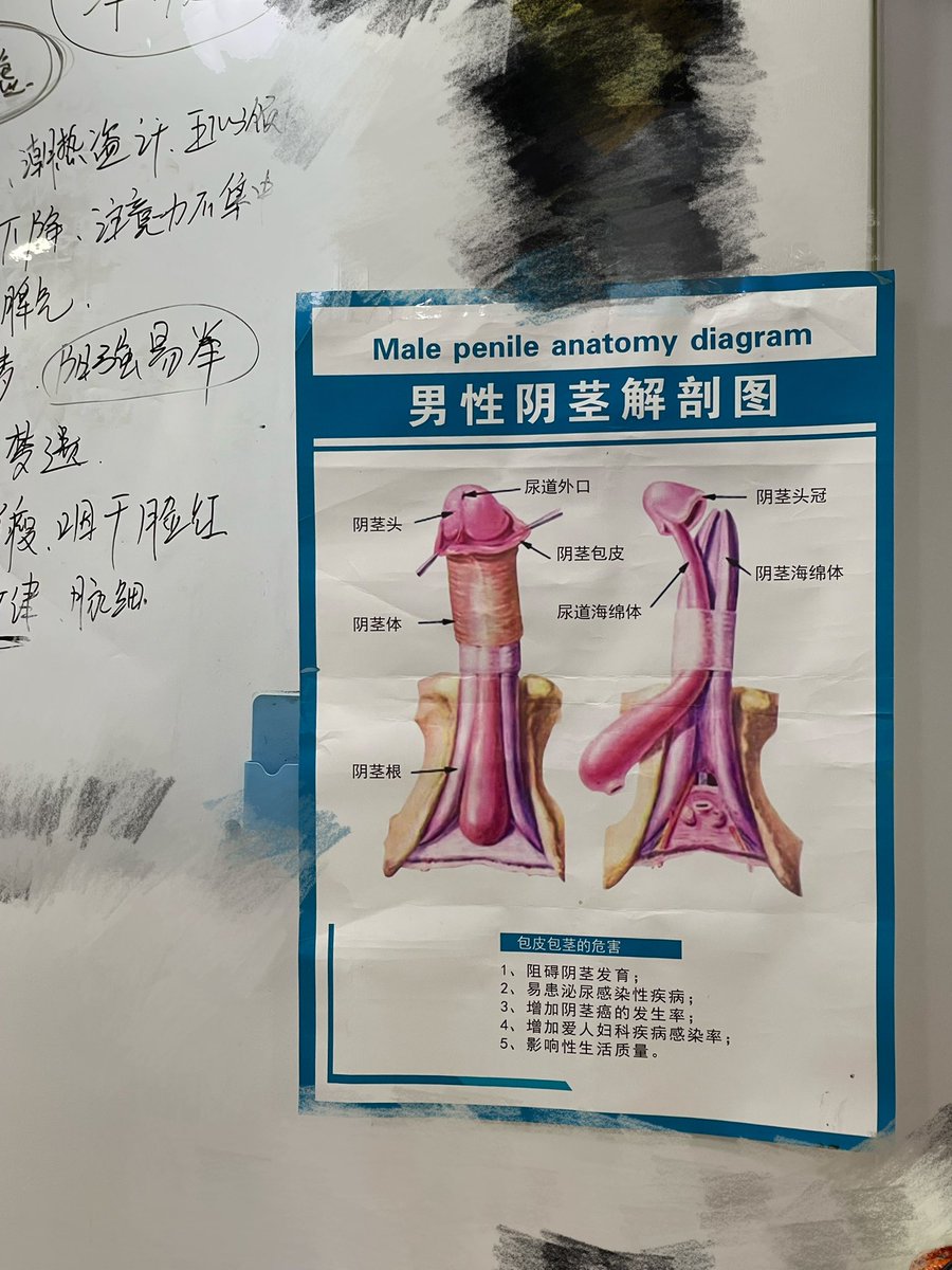 一抬头就是大阴茎😅真是3Q https://t.co/BuSuRMAQas