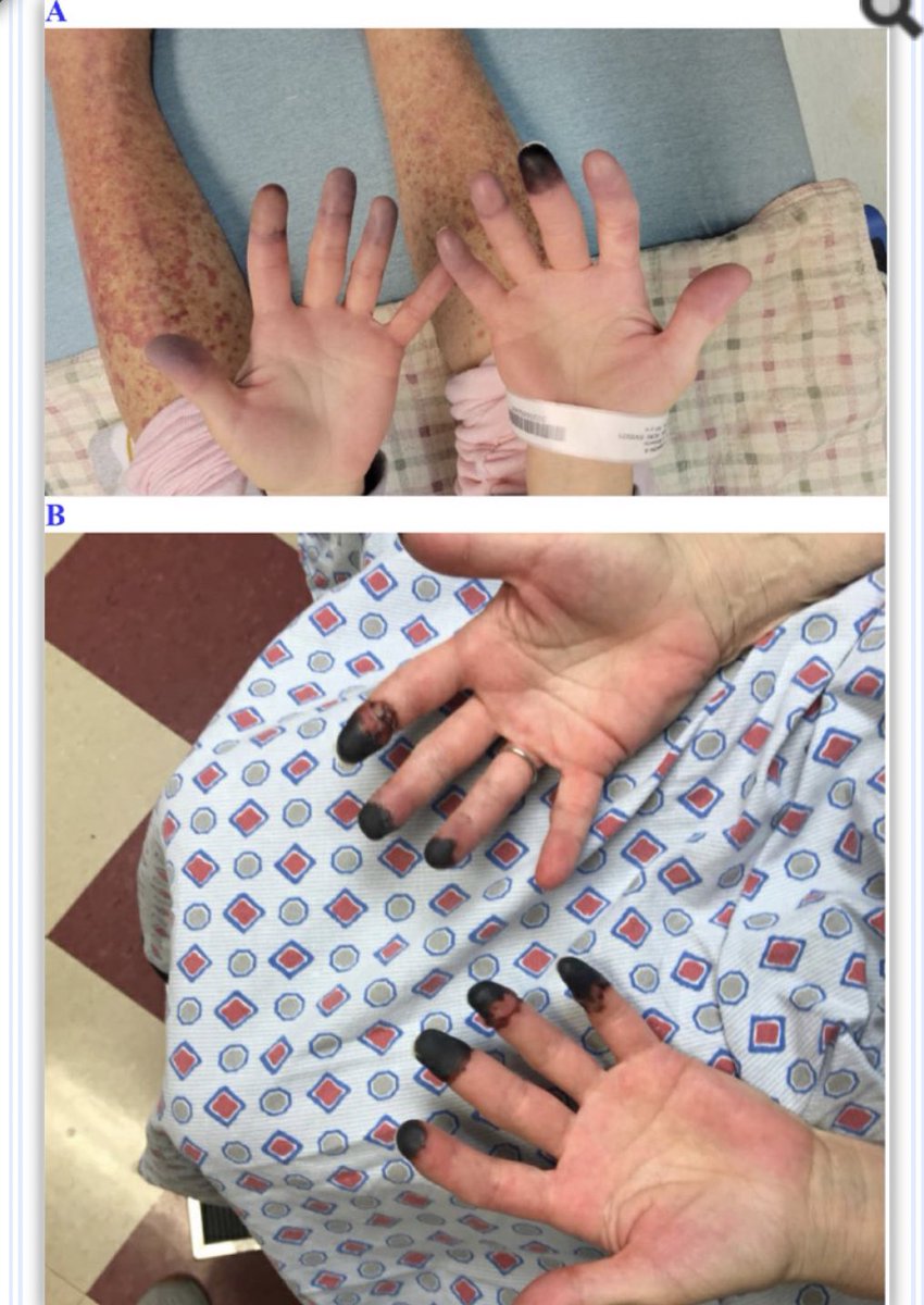 Storiesofinjury's tweet image. #ExposePfizer