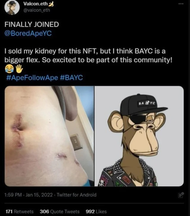 kryptonions's tweet photo. Solid move dude, see you on monday for dialysis hang

#NFTcommunity https://t.co/xIljN3N2Cv
