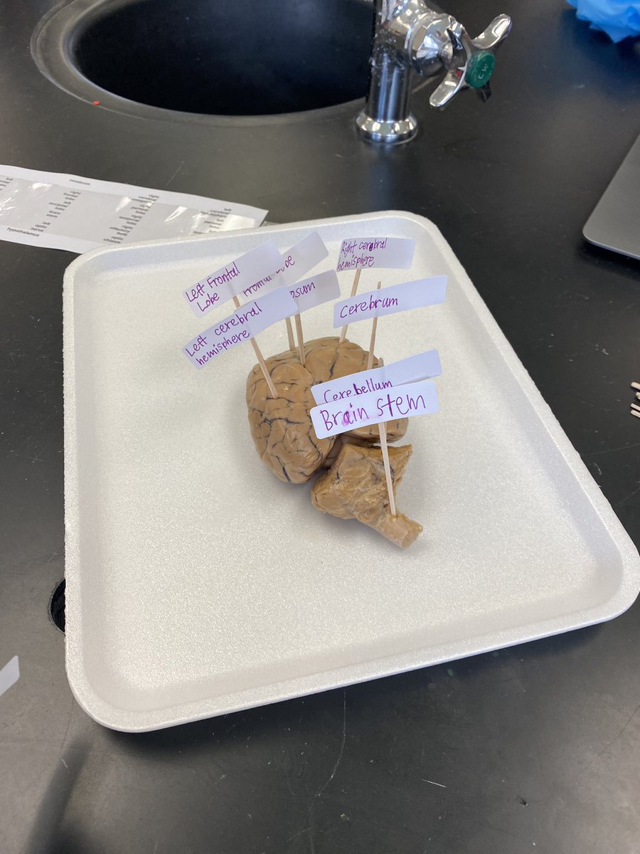 DeniseGoodliffe's tweet photo. Sheep brain day. #pltw #7grade #edgemont https://t.co/5ZmdoHY64G