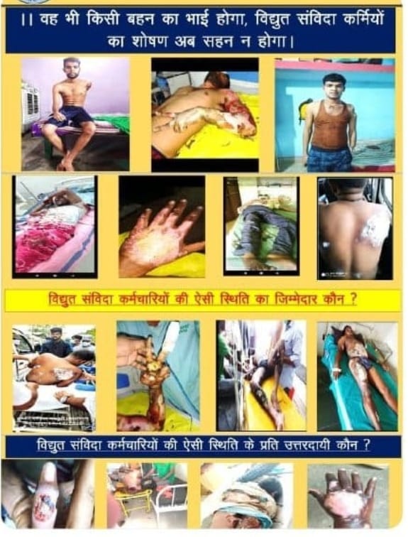 छत्तीसगढ़ के माटीपुत्र कहे जाने वाले मुख्यमंत्री श्री <a href="/bhupeshbaghel/">Bhupesh Baghel</a> जी का छत्तीसगढ़ के युवाओं के साथ ऐसा अन्याय घोर निंदनीय है।। 
विद्युत संविदा कर्मचारियों को न्याय दो
#CG_With_विद्युतसंविदा_कर्मचारीसंघ <a href="/rahulraoinc/">𝐑𝐚a𝐡𝐮𝐥 𝐑𝐚𝐨 भारत यात्री راہول راؤ</a> <a href="/plpunia/">P L Punia</a> <a href="/INCIndia/">Congress</a> <a href="/drramansingh/">Dr Raman Singh</a> @brijmohanagra20 <a href="/RajeshMunat/">Rajesh munat</a>