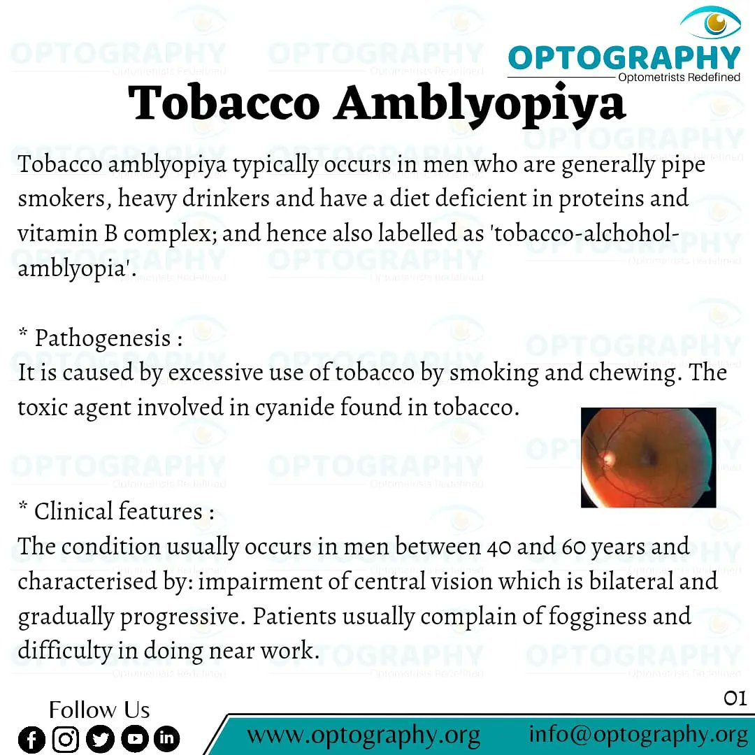 tobacco amblyopia Tobacco amblyopia is a form of toxic amblyopia caused by tobacco containing  cyanide. Tobacco amblyopia is marked by a gradual impairment of vision  characterised by visual field defects and hindered central vision. #