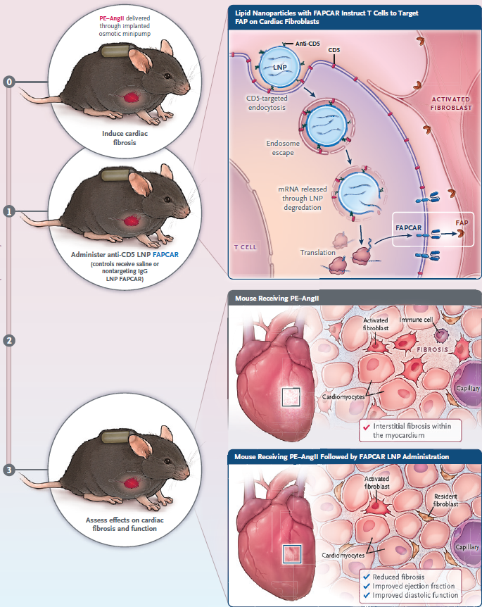 Bruce Levine, Ph.D. 🇺🇦🥼🔬🧬🧪💉 (@bllphd) on Twitter photo <a href="/NEJM/">NEJM</a> Fighting Cardiac Fibrosis with CAR T Cells- Clinical Implications of Basic Research "An advance for several reasons" 1) off the shelf CAR T cells 2) transient expression 3) remarkable lipid nanoparticle safety record <a href="/PennMedicine/">Penn Medicine</a> <a href="/WeissmanLab/">The Drew Weissman Lab</a>
<a href="/JonEpsteinLab/">Jon Epstein Lab</a> <a href="/carlhjune/">Carl June</a> <a href="/NEJM/">NEJM</a> Fighting Cardiac Fibrosis with CAR T Cells- Clinical Implications of Basic Research "An advance for several reasons" 1) off the shelf CAR T cells 2) transient expression 3) remarkable lipid nanoparticle safety record <a href="/PennMedicine/">Penn Medicine</a> <a href="/WeissmanLab/">The Drew Weissman Lab</a>
<a href="/JonEpsteinLab/">Jon Epstein Lab</a> <a href="/carlhjune/">Carl June</a>