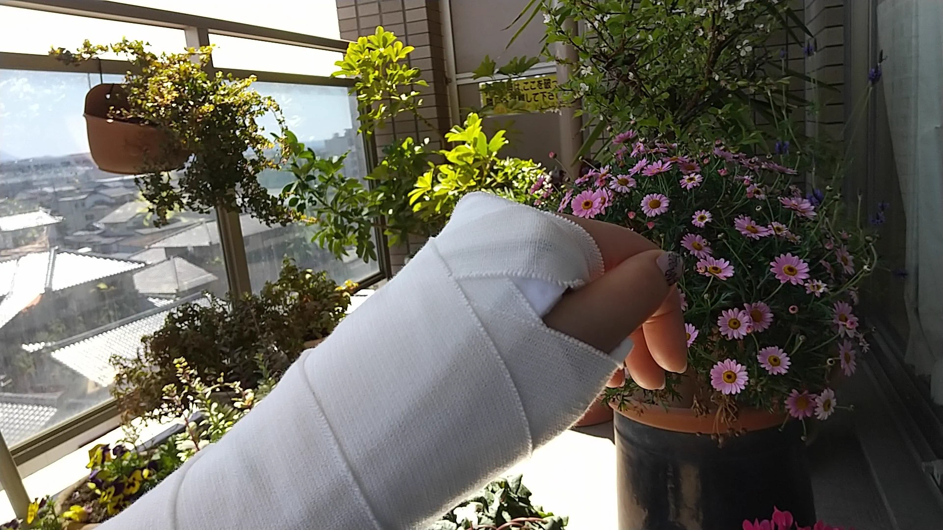 @mizukipro 左手骨折したばかりの私。リハビリ頑張ろうと思いました!! 