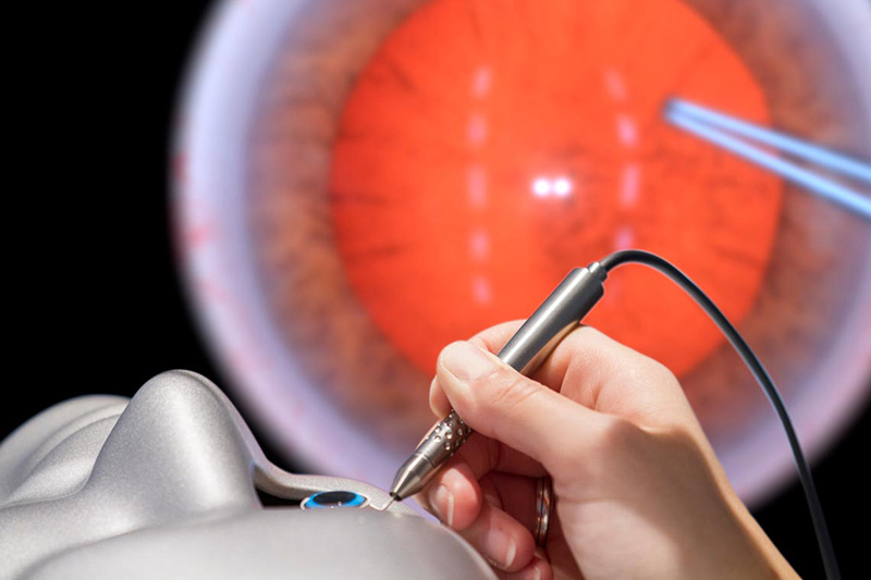 HS_UK's tweet image. HS-UK will be hosting a competition on the Eyesi Surgical virtual reality simulator at this years RCOphth Congress. Put your cataract & vitreoretinal skills to the test & compete with your peers to win a daily prize! Visit hsuk.co/EyesiSurgicalC… for more info @RCOphth