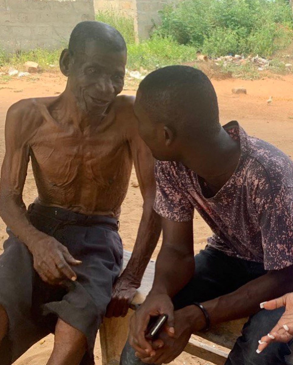 Hi friends! 

Today, for our #CaregiverAppreciation post, 
we want to appreciate Nii! 

Nii is a young man from the Dangme west community. He is a caring man who willingly helps an elderly man who is unable to get around well due his severe kyphosis (curved spine).