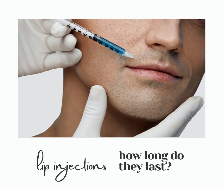 Wonder how long Lip Fillers last? Or if your lips will return to their normal appearance? Read our new blog below to learn all about it. &amp; Call us today at 404.367.9005 to book your complimentary consultation w/ 1 of our 5-Star Rated aesthetic specialists. bit.ly/3s3hvn9