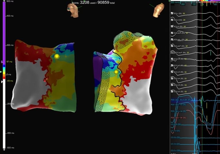 Ganesh Venkataraman tweet media