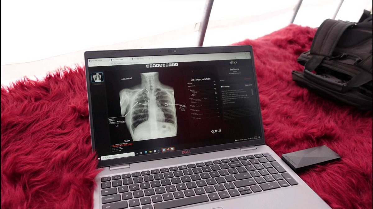 Qure.ai (@qure_ai) on Twitter photo 🚨 Team <a href="/qure_ai/">Qure.ai</a> (<a href="/pwarier/">Prashant Warier</a>, <a href="/DaraKelleher/">Dara Kelleher</a>, Sahil Chanchad) has successfully deployed qXR - our Chest X-ray screening tool, at 🏔️Everest Base Camp (alt. 5364m). Many thanks to <a href="/RogueRad/">Saurabh Jha</a> of <a href="/PennRadiology/">Penn Radiology</a> & <a href="/MinXray_Inc/">MinXray, Inc.</a>'s Mike Cairnie for being integral to this landmark expedition 🚨 Team <a href="/qure_ai/">Qure.ai</a> (<a href="/pwarier/">Prashant Warier</a>, <a href="/DaraKelleher/">Dara Kelleher</a>, Sahil Chanchad) has successfully deployed qXR - our Chest X-ray screening tool, at 🏔️Everest Base Camp (alt. 5364m). Many thanks to <a href="/RogueRad/">Saurabh Jha</a> of <a href="/PennRadiology/">Penn Radiology</a> & <a href="/MinXray_Inc/">MinXray, Inc.</a>'s Mike Cairnie for being integral to this landmark expedition