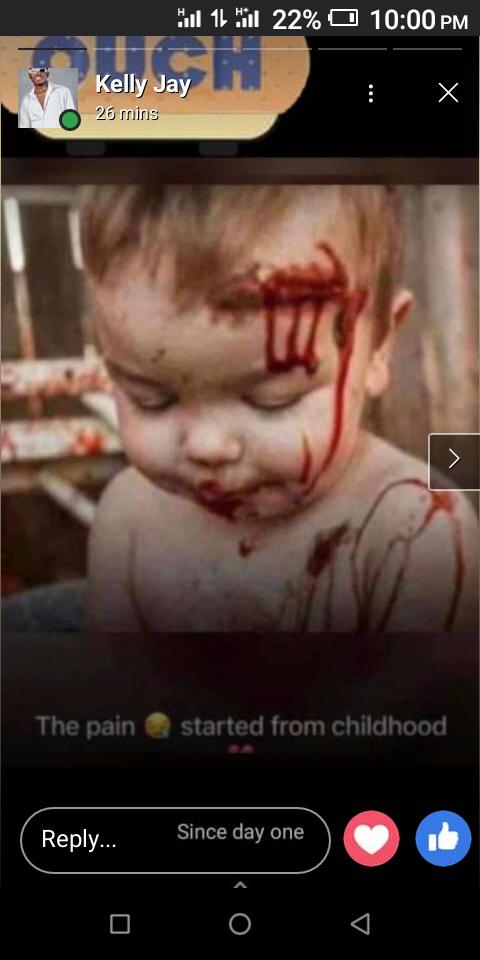 The pain started since day one ❤️❤️💙