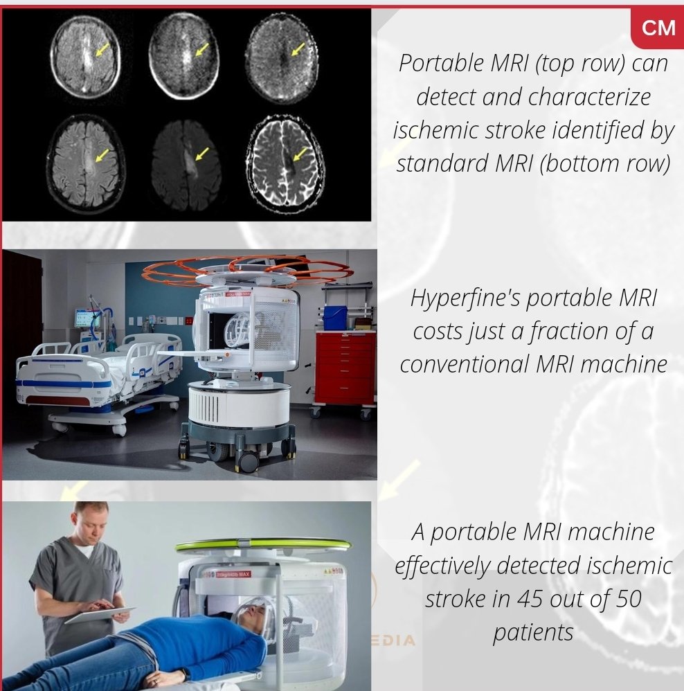 itscareermedia's tweet photo. #medicalscience #portableMRImachine #brain
World's first Portable MRI can accurately detect most common form of stroke https://t.co/pkQrdPe53Z