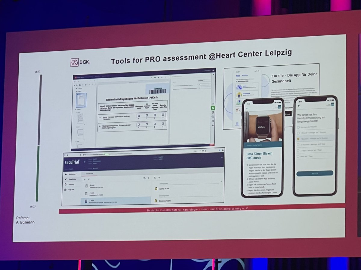 Dominik Linz (@dominik_linz) on Twitter photo <a href="/ABollmannMD/">Andreas Bollmann</a>
PROs & PROMs in #AFib
👉🏻 AFEQT: paper, online, app 👌🏻
<a href="/Rhythmisit/">Inga Drossart</a> <a href="/J_Hendriks1/">Jeroen Hendriks</a> <a href="/PrashSanders/">Prash Sanders</a>
#DGKJahrestagung <a href="/DGK_org/">Deutsche Gesellschaft für Kardiologie</a> <a href="/GerdHindricks/">Gerhard Hindricks</a> <a href="/ABollmannMD/">Andreas Bollmann</a>
PROs & PROMs in #AFib
👉🏻 AFEQT: paper, online, app 👌🏻
<a href="/Rhythmisit/">Inga Drossart</a> <a href="/J_Hendriks1/">Jeroen Hendriks</a> <a href="/PrashSanders/">Prash Sanders</a>
#DGKJahrestagung <a href="/DGK_org/">Deutsche Gesellschaft für Kardiologie</a> <a href="/GerdHindricks/">Gerhard Hindricks</a>