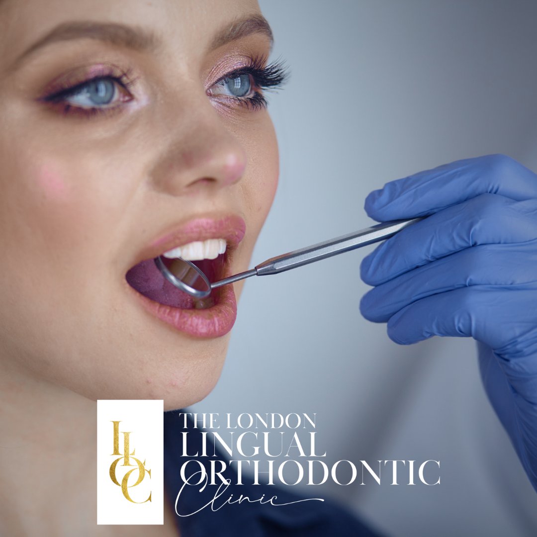Give us a call today on 020 7486 2883 to speak to a member of our lovely team, where you can book a consultation to start your #dental journey! 

#LLOC #LondonLingual