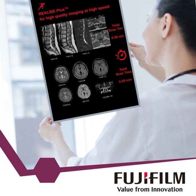 Joao_B's tweet photo. ๐ค Did you know that with REALISE Plus, you do not need to fear that short scan time will result in poor #MRI image quality?
๐ For more about this innovative MR technology ๐๏ธ ๐
https://t.co/iBjrU5RCmF
@FUJIFILM_HCEMEA #Radiology #EchelonSmartPlus #RealisePlus #digitalhealth https://t.co/4sDlJoqg6R