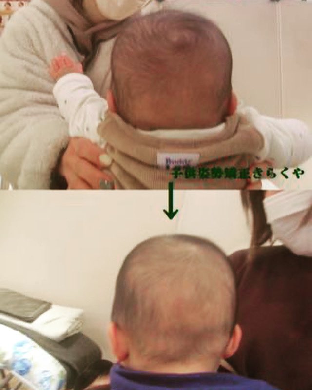 美容整体きらくや Kirakuya03 Twitter