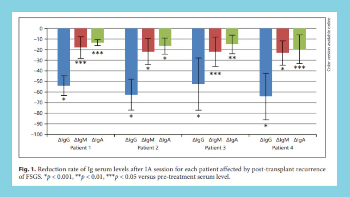 NephroKarger's tweet photo. Therapeutic Approach for Recurrent Focal Segmental Glomerulosclerosis in Pediatric Renal Transplant Recipients: A Single-Center Experience
✍ Diletta Domenica Torres
📑 https://t.co/xrL0wt1J7E
#BloodPurif #Immunoadsorption #KidneyTransplantation #FSGS https://t.co/vKSeyXUJhs