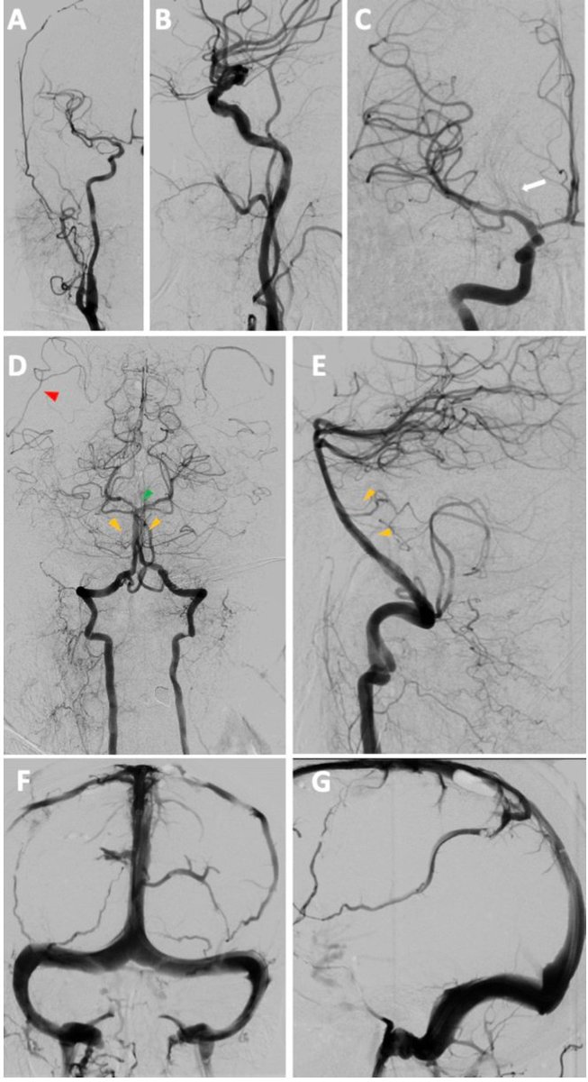 Transcatheter Neurosurgical Technologies Lab tweet media