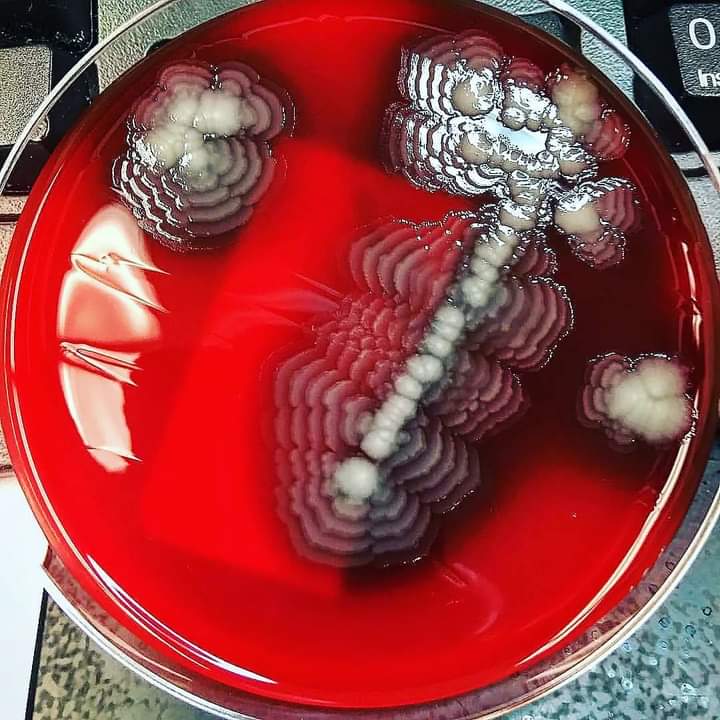 CDC_MicroBio's tweet photo. Proteus ❤️ https://t.co/lgh5OaMQ5B
