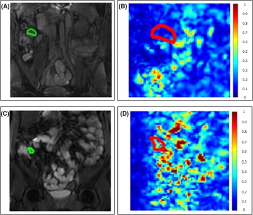 Kewin Siah tweet media