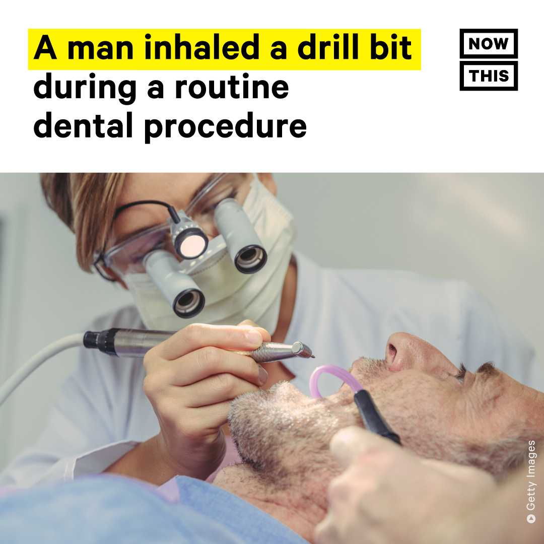 nowthisimpact's tweet photo. A man inhaled a 1-inch dental drill bit during a dentist visit, and it ended up deep in his lung. The patient said he was getting his tooth filled when he was told he swallowed a tool. https://t.co/j1DuAHIxnj