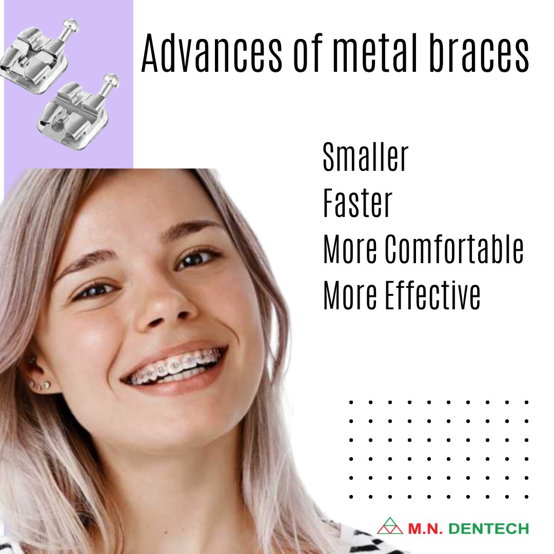 mndentech's tweet photo. ✅ Metal or traditional braces are the most common type of braces world-wide and have been around for over 100 years now.
Metal braces are most popular among children and adolescent patients. They work by applying the braces to the teeth and connecting them with a wire.  
#teeth https://t.co/rbPOW1RnIV
