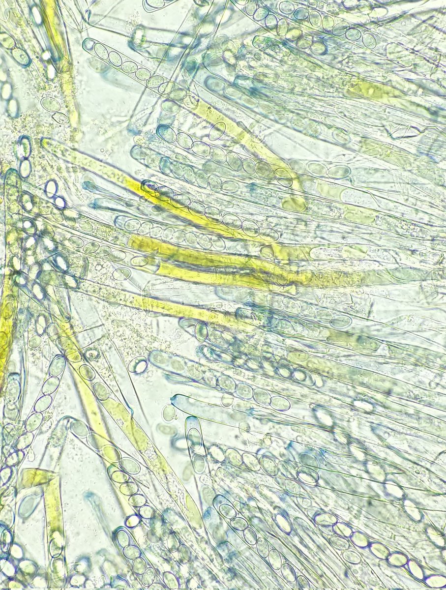 Jassydrak's tweet photo. This Peziza - note the asci tips turn blue with Melzers - had me going round in circles with the species name... Tempted to barcode it and with backwards ๐๐ #BMS125 #mycology https://t.co/x6CKw5OG32