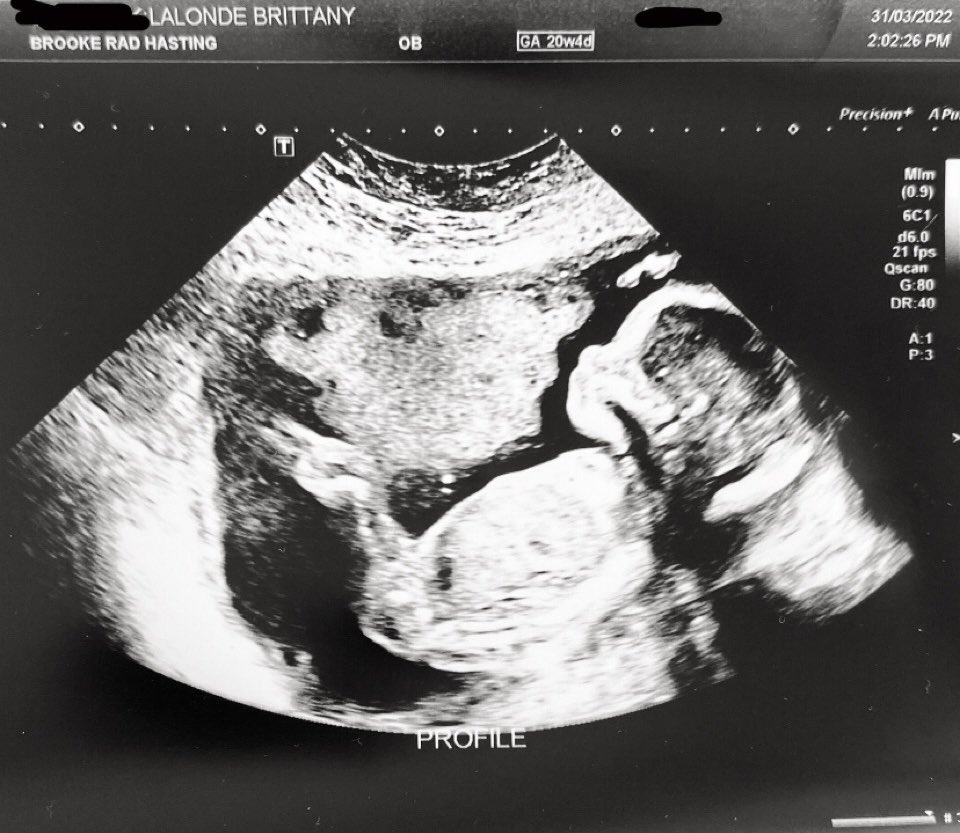 Patrick C. Lalonde, Ph.D. tweet media