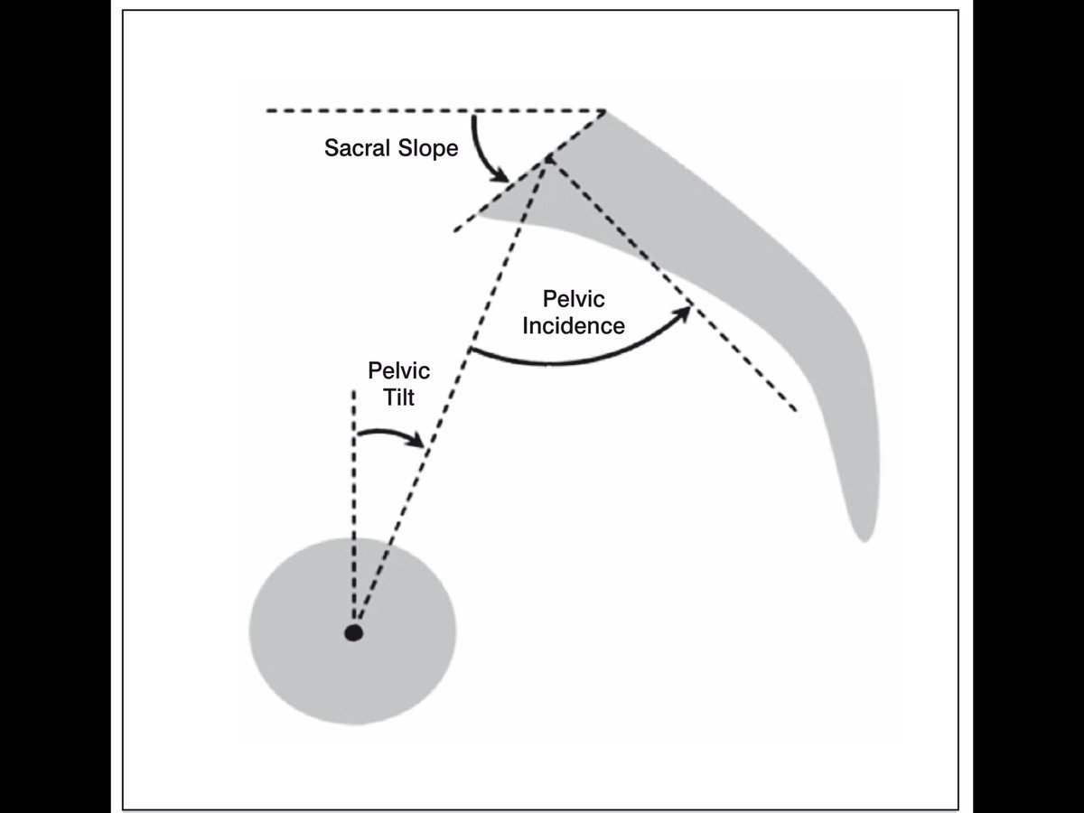 AjayLallMD's tweet photo. @atmghn When prepping for THA, I’m always interested in lumbo-pelvic motion from sit-to-stand and vice versa. https://t.co/aVAxNhGtSO