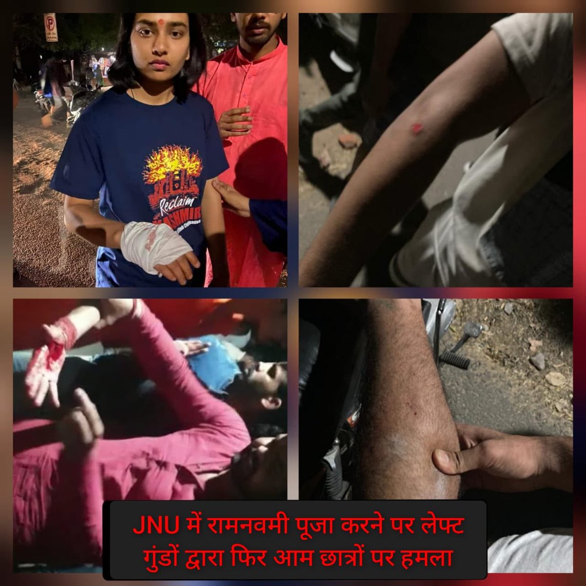 राम नवमी में कार्यक्रम में सम्मिलित होने आए दिव्यांग छात्र व अन्य JNU के छात्र/छात्राओं पर लाल आतंकियों द्वारा सुनियोजित तरीक़े से पथराव व घातक हथियारों से हमला किया गया। 

#LeftAgainstRam #LeftViolenceInJNU