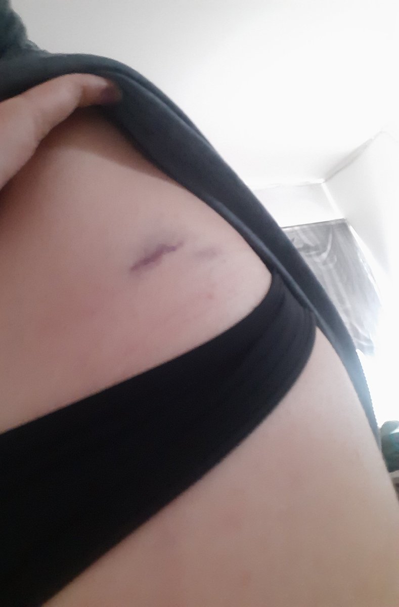 ❥ 𝑻𝒘𝒊𝒏𝒔 𝑱𝒊𝒏𝒙 🌩 tweet media