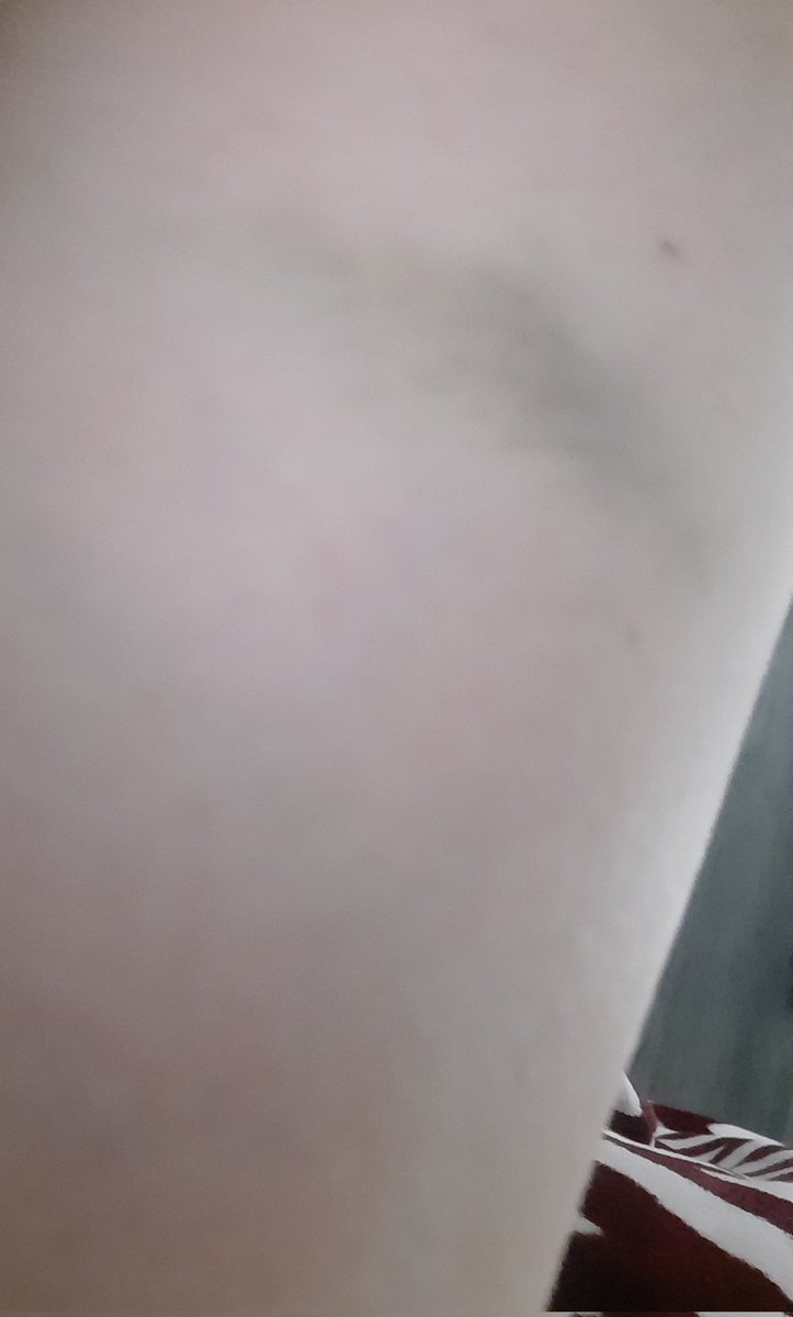 ❥ 𝑻𝒘𝒊𝒏𝒔 𝑱𝒊𝒏𝒙 🌩 tweet media