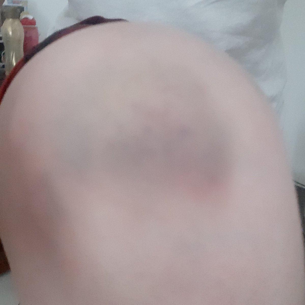 ❥ 𝑻𝒘𝒊𝒏𝒔 𝑱𝒊𝒏𝒙 🌩 tweet media