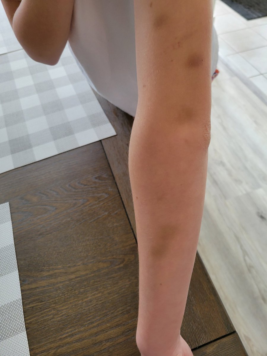 barnegatythlax's tweet photo. Girls lacrosse is a " No Contact Sport "  Our 7/8 girls played 2 rough games yesterday and came out with a double win! This team is one to watch!@BarnegatGLax https://t.co/skFUysvz4R