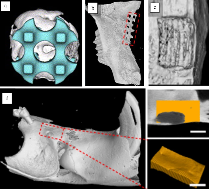 MRSBulletin's tweet photo. From #MRSBulletin: Unlike autografts and allografts, #3Dprinted scaffolds can satisfy the need for personalized bony reconstruction after massive #craniofacial bone loss. The authors summarize #3Dprinting technologies for craniofacial #bonereconstruction.
https://t.co/BsbueexQ8Q https://t.co/vg07fOK3Cc