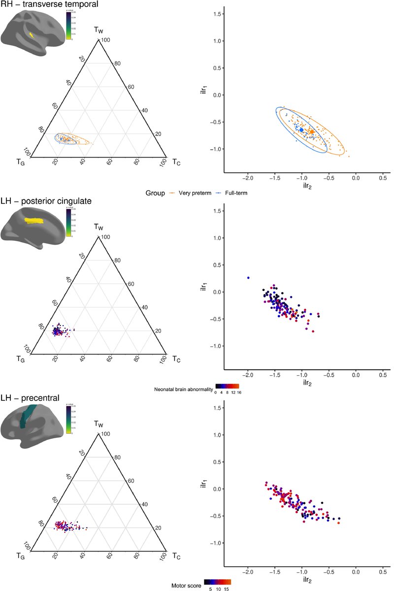 Claire Kelly (@claire_e_kelly) on Twitter photo Our recent work investigates the microstructural and free-water composition of the white matter and cortical grey matter in children born very preterm and at term. It is now available in <a href="/NeuroImage_EiC/">NeuroImage</a>: doi.org/10.1016/j.neur… Our recent work investigates the microstructural and free-water composition of the white matter and cortical grey matter in children born very preterm and at term. It is now available in <a href="/NeuroImage_EiC/">NeuroImage</a>: doi.org/10.1016/j.neur…