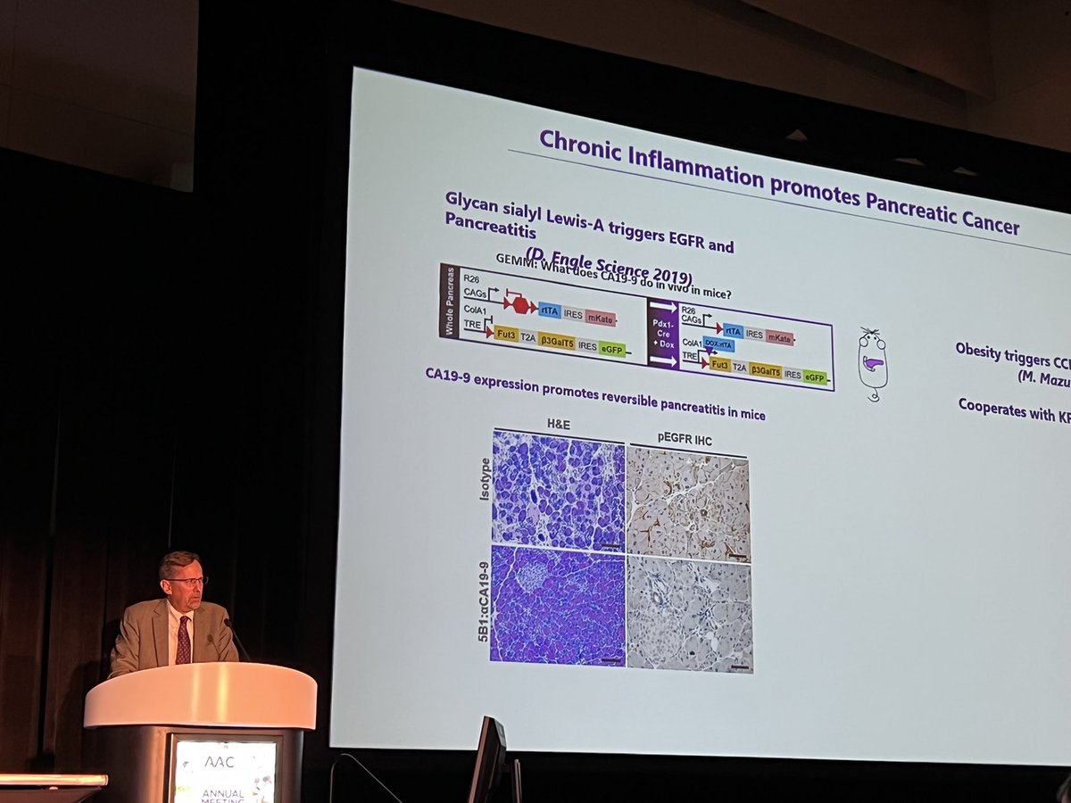 Dr. Dannie (@dannieengle) on Twitter photo 7 deadly features of pancreatic cancer, some vignettes including foundational work by <a href="/CancerHacker/">Tobiloba Oni</a> <a href="/BiffiGiulia/">Giulia Biffi</a> <a href="/HerveTiriac/">Herve Tiriac</a> <a href="/DennisPlenker/">Dennis Plenker</a> <a href="/AmberHabowski/">Dr. Amber Habowski</a> and many others! 7 deadly features of pancreatic cancer, some vignettes including foundational work by <a href="/CancerHacker/">Tobiloba Oni</a> <a href="/BiffiGiulia/">Giulia Biffi</a> <a href="/HerveTiriac/">Herve Tiriac</a> <a href="/DennisPlenker/">Dennis Plenker</a> <a href="/AmberHabowski/">Dr. Amber Habowski</a> and many others!