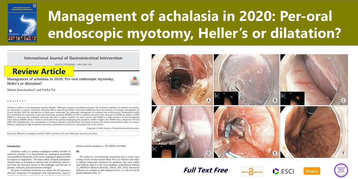 Society of Gastrointestinal Intervention (@ijgii_sgi) on Twitter photo Management of achalasia in 2020: Per-oral #endoscopic_myotomy, Heller’s or dilatation?
open access🌷bit.ly/37CWDLN
most read article, IJGII 2020
Mohan Ramchandani <a href="/drmohanjr/">Mohan Ramchandani</a>
Partha Pal @ParthaP32580643 Management of achalasia in 2020: Per-oral #endoscopic_myotomy, Heller’s or dilatation?
open access🌷bit.ly/37CWDLN
most read article, IJGII 2020
Mohan Ramchandani <a href="/drmohanjr/">Mohan Ramchandani</a>
Partha Pal @ParthaP32580643