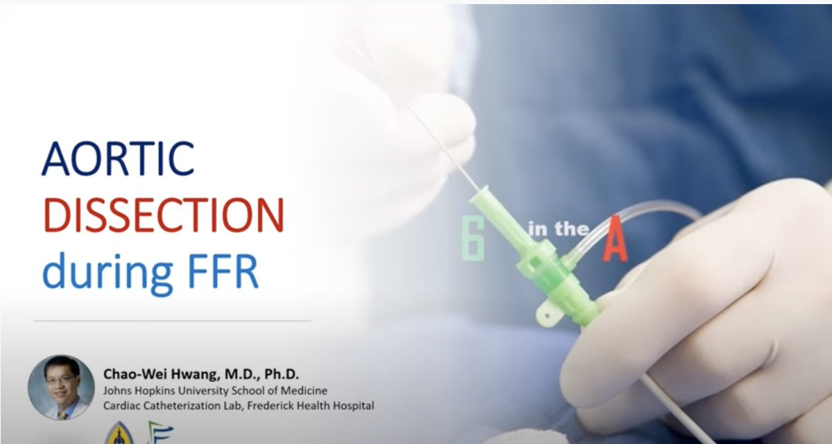 Johns Hopkins Cardiology (@hopkinsheart) on Twitter photo <a href="/HwangChao/">Chao-Wei Hwang</a> discusses a hair-raising case of Aortic Dissection during FFR.
youtu.be/5kCZ9GpgHWo
<a href="/PranoHiremath/">Pranoti Hiremath</a> <a href="/DoctorLatina/">Dr. Jacqueline Latina</a> <a href="/Dr_DanMD/">Daniel Ambinder, MD</a> <a href="/KhalilIbrahimMD/">Khalil Ibrahim</a> <a href="/frahman480/">Dr. Faisal Rahman</a> <a href="/DocMehta407/">Hetal H. Mehta, MD, FACC, FSCAI</a> <a href="/RaniKHasan/">Rani Hasan</a> <a href="/PeterBa62210592/">Peter Barr</a> <a href="/DrAnthonyP/">Anthony D Pisaniello</a> <a href="/HwangChao/">Chao-Wei Hwang</a> discusses a hair-raising case of Aortic Dissection during FFR.
youtu.be/5kCZ9GpgHWo
<a href="/PranoHiremath/">Pranoti Hiremath</a> <a href="/DoctorLatina/">Dr. Jacqueline Latina</a> <a href="/Dr_DanMD/">Daniel Ambinder, MD</a> <a href="/KhalilIbrahimMD/">Khalil Ibrahim</a> <a href="/frahman480/">Dr. Faisal Rahman</a> <a href="/DocMehta407/">Hetal H. Mehta, MD, FACC, FSCAI</a> <a href="/RaniKHasan/">Rani Hasan</a> <a href="/PeterBa62210592/">Peter Barr</a> <a href="/DrAnthonyP/">Anthony D Pisaniello</a>