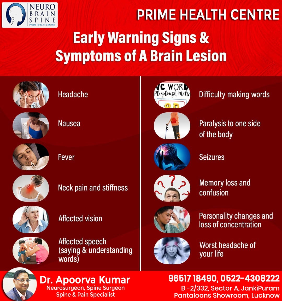 centre_prime's tweet photo. #neurosurgeon #neurosurgery #braintumor #migraine #headache #headinjury #trianglemindtechnologies
 
Dr.  Apoorva Kumar
Neuro &amp; Spine Surgeon and Pain Specialist
Prime Health Centre
B-2/332, Sector A, Jankipuram, 
Near Pantaloons Showroom, 
Lucknow
Mobile : 9651718490 https://t.co/yHuyeUlLuY