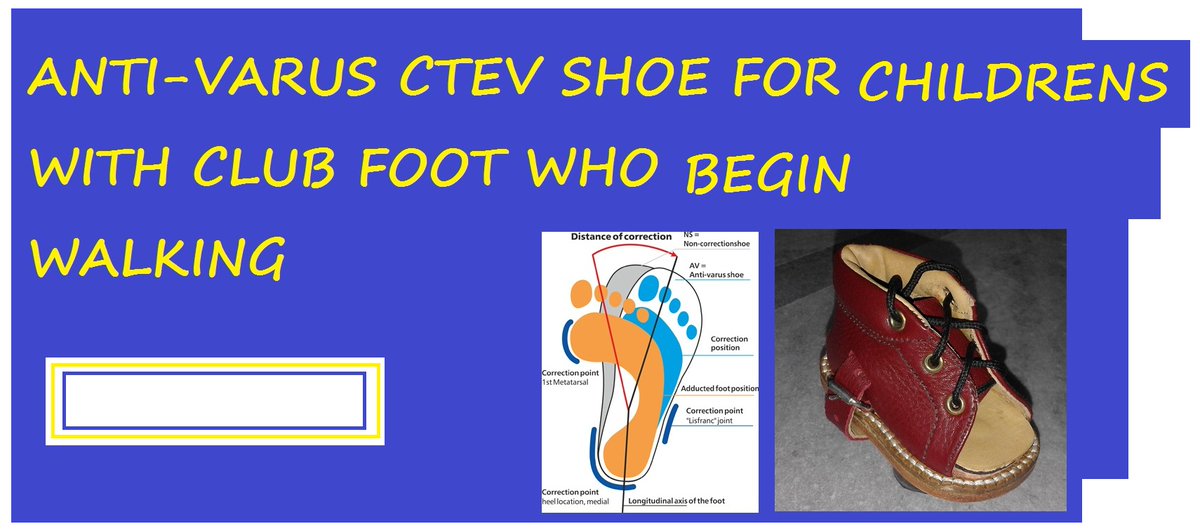 foot correction specialists in hyderabad #footcorrection #ctev #clubfoot #flatfeet #pesplanus #higharch #heelpain #kneepain #orthopedic #diabetic #antivarus_ctev #clubfootsplint