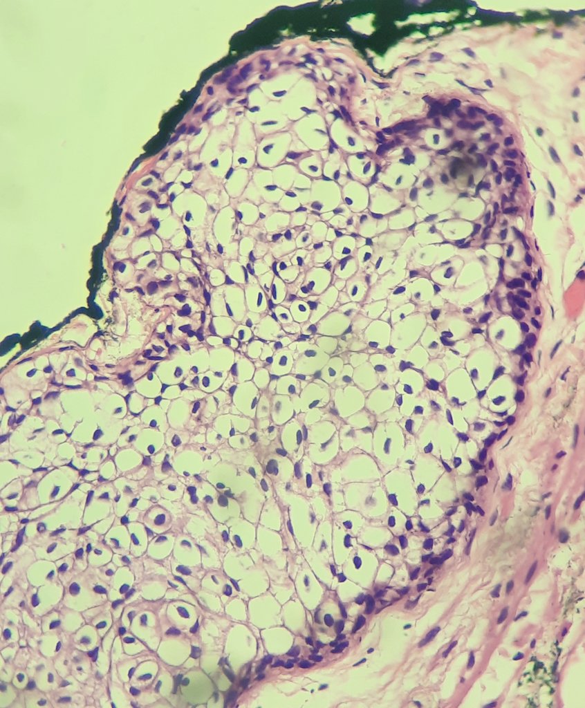 Location - fallopian tube