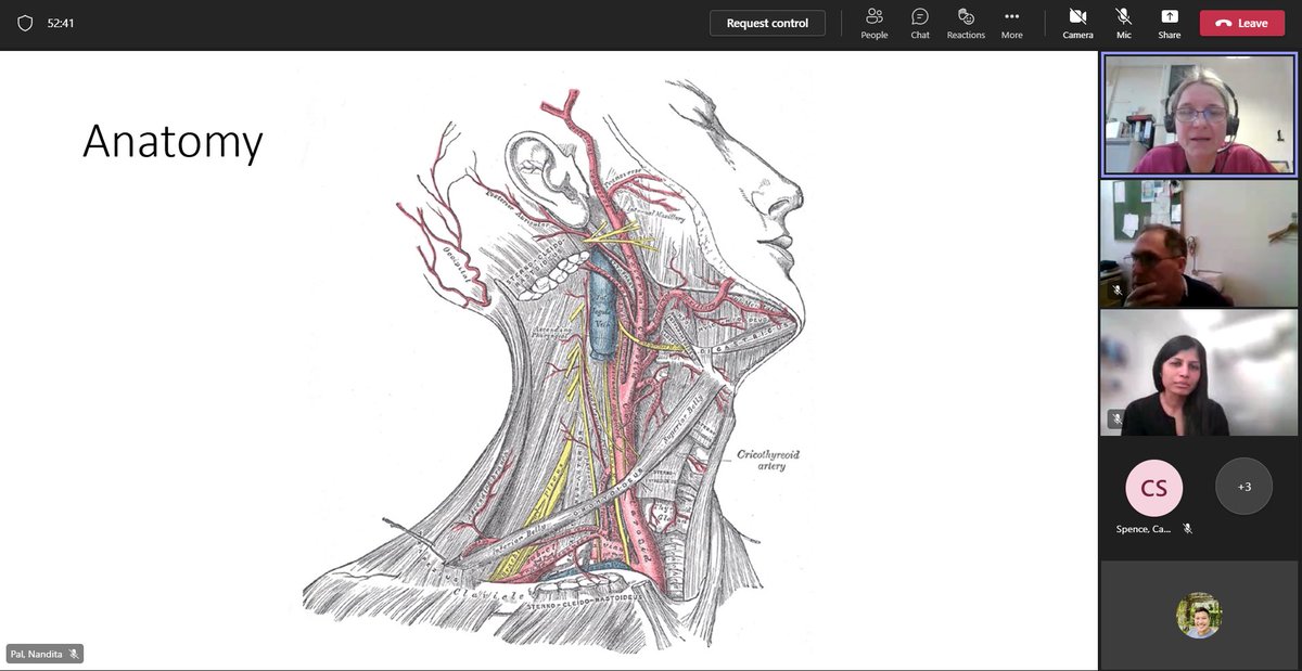 JeanPaul Evangelista (He/Him) (@jeaneva03) on Twitter photo Miss Sonnenberg delivering a refresher teaching on carotid disease to our vascular FY1s and radiology colleagues. Really helpful to always go back to basics so we can support our patient better alongside with our MDT. #workingtogether #patientfirst <a href="/UnitVascular/">Southampton Vascular Unit</a> Miss Sonnenberg delivering a refresher teaching on carotid disease to our vascular FY1s and radiology colleagues. Really helpful to always go back to basics so we can support our patient better alongside with our MDT. #workingtogether #patientfirst <a href="/UnitVascular/">Southampton Vascular Unit</a>