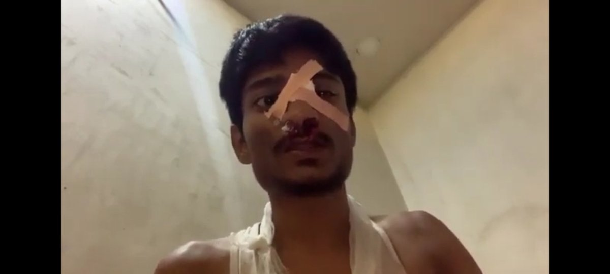 paras_for's tweet photo. A youtuber named paras official got attacked from a bgmi player Daku. 
Daku had also threatened to kill him before. The next day 7-8 people came to his house to hit him and his mother too. He is in a very serious condition now. Please help @PunjabPoliceInd  @DGPPunjabPolice https://t.co/TFr1PWsh4q